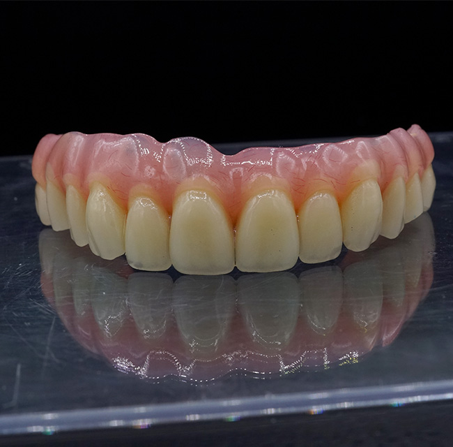 Immagine Protesi provvisorie: perch&eacute; sono importanti e come sono realizzate